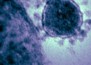 Coronaviruset uppges ha nått USA