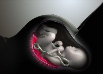 Nya Zeeland röstar igenom extrem abortlagstiftning